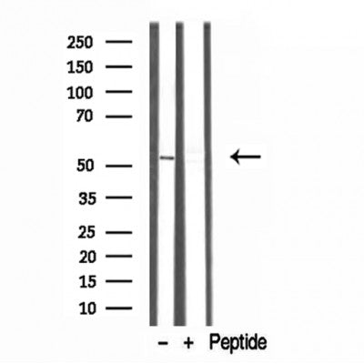 Western blot analysis of extracts from various samples, using TRIM44 antibody.
 Lane 1: rat heart treated with blocking peptide.
 Lane 2: Rat heart;
 Lane 3: Hepg2;
 