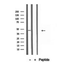 Western blot analysis of extracts from mouse brain, using TTL antibody. Lane 1 was treated with the blocking peptide.