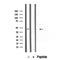 Western blot analysis of extracts from mouse brain, using TTL antibody. Lane 1 was treated with the blocking peptide.