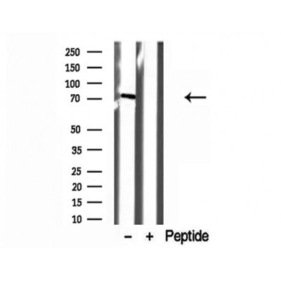 DF12181 at 1/100 staining Human lung tissue by IHC-P. The sample was formaldehyde fixed and a heat mediated antigen retrieval step in citrate buffer was performed. The sample was then blocked and incubated with the antibody for 1.5 hours at 22¡ãC. An HRP conjugated goat anti-rabbit antibody was used as the secondary