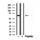 Western blot analysis of extracts from B6F10, using YTHDF2 antibody. Lane 1 was treated with the blocking peptide.