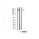 Western blot analysis of extracts from various samples, using ZCCHC11 antibody.
 Lane 1: hepg2 treated with blocking peptide.
 Lane 2: Hepg2;
 Lane 3: B16F10;
 