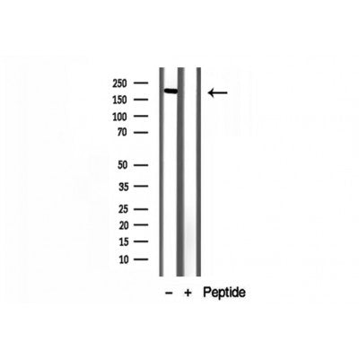 Western blot analysis of extracts from various samples, using ZCCHC11 antibody.
 Lane 1: hepg2 treated with blocking peptide.
 Lane 2: Hepg2;
 Lane 3: B16F10;
 