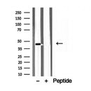 Western blot analysis of extracts from rat heart, using ACADS antibody. Lane 1 was treated with the blocking peptide.