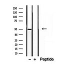Western blot analysis of extracts from various samples, using AP1M1 antibody.
 Lane 1: rat heart treated with blocking peptide.
 Lane 2: Rat heart;
 Lane 3: Mouse brain;
 Lane 4: Hepg2;
 Lane 5: B16F10;
 