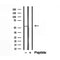 Western blot analysis of extracts from HepG2, using BCS1L antibody. Lane 1 was treated with the blocking peptide.
