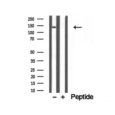 Western blot analysis of extracts from various samples, using Collagen Type VI antibody.
 Lane 1: rat heart treated with blocking peptide.
 Lane 2: Rat heart;
 Lane 3: Mouse brain;
 