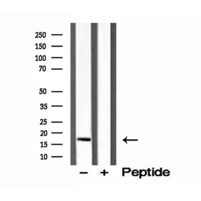 Western blot analysis of extracts from mouse brain, using CPLX1 antibody. Lane 1 was treated with the blocking peptide.