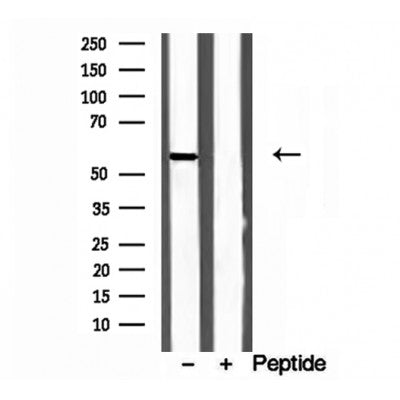 Western blot analysis of extracts from rat heart, using CYP26B1 antibody. Lane 1 was treated with the blocking peptide.