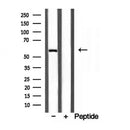 Western blot analysis of extracts from Rat spleen, using D2HGDH Antibody. The lane on the left was treated with blocking peptide.