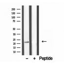 Western blot analysis of extracts from Mouse liver, using Dermatopontin Antibody. Lane 1 was treated with the blocking peptide.