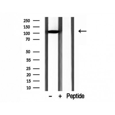 DF12197 at 1/100 staining Rat colon tissue by IHC-P. The sample was formaldehyde fixed and a heat mediated antigen retrieval step in citrate buffer was performed. The sample was then blocked and incubated with the antibody for 1.5 hours at 22¡ãC. An HRP conjugated goat anti-rabbit antibody was used as the secondary
