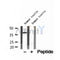 DF12198 at 1/100 staining Mouse lung tissue by IHC-P. The sample was formaldehyde fixed and a heat mediated antigen retrieval step in citrate buffer was performed. The sample was then blocked and incubated with the antibody for 1.5 hours at 22¡ãC. An HRP conjugated goat anti-rabbit antibody was used as the secondary
