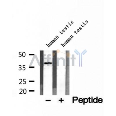 DF12198 at 1/100 staining Mouse lung tissue by IHC-P. The sample was formaldehyde fixed and a heat mediated antigen retrieval step in citrate buffer was performed. The sample was then blocked and incubated with the antibody for 1.5 hours at 22¡ãC. An HRP conjugated goat anti-rabbit antibody was used as the secondary