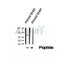DF12200 at 1/100 staining Human liver cancer tissue by IHC-P. The sample was formaldehyde fixed and a heat mediated antigen retrieval step in citrate buffer was performed. The sample was then blocked and incubated with the antibody for 1.5 hours at 22¡ãC. An HRP conjugated goat anti-rabbit antibody was used as the secondary