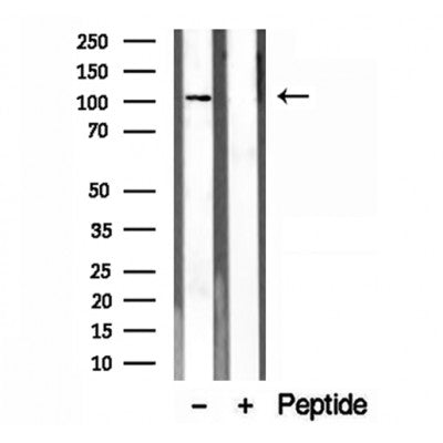 DF12201 staining Hela by IF/ICC. The samples were fixed with PFA and permeabilized in 0.1% Triton X-100,then blocked in 10% serum for 45 minutes at 25¡ãC. Samples were then incubated with primary Ab(DF12201 1:200) and mouse anti-beta tubulin Ab(T0023 1:200) for 1 hour at 37¡ãC. An  AlexaFluor594 conjugated goat anti-rabbit IgG(H+L) Ab(S0006 1:200 Red) and an AlexaFluor488 conjugated goat anti-mouse IgG(H+L) Ab(S0017 1:600 Green) were used as the secondary antibod