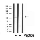 Western blot analysis of extracts from various samples, using FAF2 Antibody. 
Lane 1: 293 cells treated with the blocking peptide;
Lane 2: 293 celss;
Lane 3: Hela cells;
Lane 4: Mouse liver tissue.