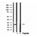 Western blot analysis of extracts from Mouse liver, using ICT1 Antibody. Lane 1 was treated with the blocking peptide.