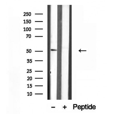 Western blot analysis of extracts from Mouse brain, using IFT52 Antibody. Lane 1 was treated with the blocking peptide.