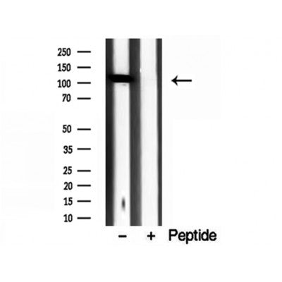 Western blot analysis of extracts from various samples, using IPO4 Antibody.
Lane 1: 293 cells treated with the blocking peptide;
Lane 2: 293 cells;
Lane 3: Hela cells.