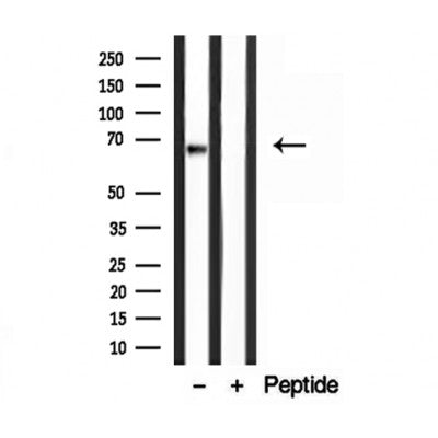 DF12209 staining HepG2 by IF/ICC. The sample were fixed with PFA and permeabilized in 0.1% Triton X-100,then blocked in 10% serum for 45 minutes at 25¡ãC. The primary antibody was diluted at 1/200 and incubated with the sample for 1 hour at 37¡ãC. An  Alexa Fluor 594 conjugated goat anti-rabbit IgG (H+L) Ab, diluted at 1/600, was used as the secondary antibod