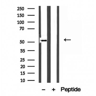 DF12210 staining Hela by IF/ICC. The sample were fixed with PFA and permeabilized in 0.1% Triton X-100,then blocked in 10% serum for 45 minutes at 25¡ãC. The primary antibody was diluted at 1/200 and incubated with the sample for 1 hour at 37¡ãC. An  Alexa Fluor 594 conjugated goat anti-rabbit IgG (H+L) Ab, diluted at 1/600, was used as the secondary antibod