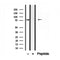 DF12211 staining Hela by IF/ICC. The samples were fixed with PFA and permeabilized in 0.1% Triton X-100,then blocked in 10% serum for 45 minutes at 25¡ãC. Samples were then incubated with primary Ab(DF12211 1:200) and mouse anti-beta tubulin Ab(T0023 1:200) for 1 hour at 37¡ãC. An  AlexaFluor594 conjugated goat anti-rabbit IgG(H+L) Ab(S0006 1:200 Red) and an AlexaFluor488 conjugated goat anti-mouse IgG(H+L) Ab(S0017 1:600 Green) were used as the secondary antibod