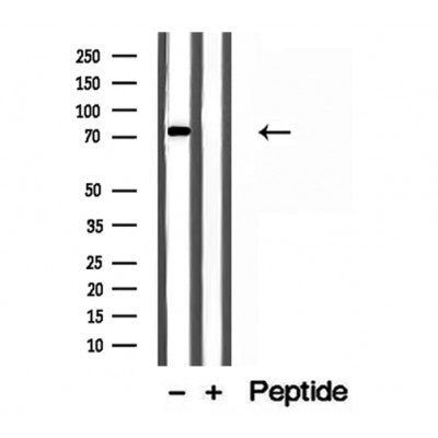 Western blot analysis of extracts from Mouse brain, using MTO1 Antibody. Lane 1 was treated with the blocking peptide.