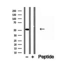 Western blot analysis of extracts from various samples, using NAPRT1 antibody.
 Lane 1: Hela treated with blocking peptide.
 Lane 2: Hela;
 Lane 3: Hepg2;
 