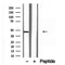 Western blot analysis of extracts from various samples, using NOB1 antibody.
 Lane 1: Hela treated with blocking peptide.
 Lane 2: Hela;
 Lane 3: Hepg2;
 