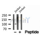 DF12218 at 1/100 staining Mouse liver tissue by IHC-P. The sample was formaldehyde fixed and a heat mediated antigen retrieval step in citrate buffer was performed. The sample was then blocked and incubated with the antibody for 1.5 hours at 22¡ãC. An HRP conjugated goat anti-rabbit antibody was used as the secondary