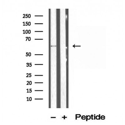 Western blot analysis of extracts from Hela, using P4HA1 Antibody. The lane on the left was treated with blocking peptide.
