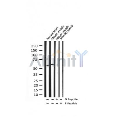 AF3369 staining HuvEc by IF/ICC. The sample were fixed with PFA and permeabilized in 0.1% Triton X-100,then blocked in 10% serum for 45 minutes at 25¡ãC. The primary antibody was diluted at 1/200 and incubated with the sample for 1 hour at 37¡ãC. An  Alexa Fluor 594 conjugated goat anti-rabbit IgG (H+L) Ab, diluted at 1/600, was used as the secondary antibod