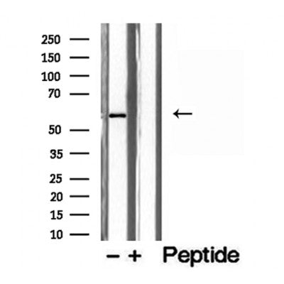 DF12220 staining HepG2 by IF/ICC. The sample were fixed with PFA and permeabilized in 0.1% Triton X-100,then blocked in 10% serum for 45 minutes at 25¡ãC. The primary antibody was diluted at 1/200 and incubated with the sample for 1 hour at 37¡ãC. An  Alexa Fluor 594 conjugated goat anti-rabbit IgG (H+L) Ab, diluted at 1/600, was used as the secondary antibod
