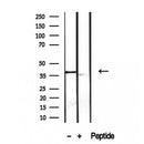 DF12224 at 1/100 staining Mouse colon tissue by IHC-P. The sample was formaldehyde fixed and a heat mediated antigen retrieval step in citrate buffer was performed. The sample was then blocked and incubated with the antibody for 1.5 hours at 22¡ãC. An HRP conjugated goat anti-rabbit antibody was used as the secondary