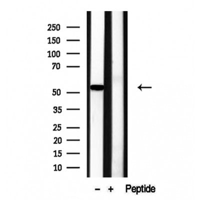 Western blot analysis of extracts from Huvec, using RCN2 Antibody. Lane 1 was treated with the blocking peptide.