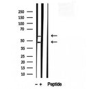 DF12229 staining HepG2 by IF/ICC. The sample were fixed with PFA and permeabilized in 0.1% Triton X-100,then blocked in 10% serum for 45 minutes at 25¡ãC. The primary antibody was diluted at 1/200 and incubated with the sample for 1 hour at 37¡ãC. An  Alexa Fluor 594 conjugated goat anti-rabbit IgG (H+L) Ab, diluted at 1/600, was used as the secondary antibod
