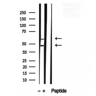 DF12229 staining HepG2 by IF/ICC. The sample were fixed with PFA and permeabilized in 0.1% Triton X-100,then blocked in 10% serum for 45 minutes at 25¡ãC. The primary antibody was diluted at 1/200 and incubated with the sample for 1 hour at 37¡ãC. An  Alexa Fluor 594 conjugated goat anti-rabbit IgG (H+L) Ab, diluted at 1/600, was used as the secondary antibod