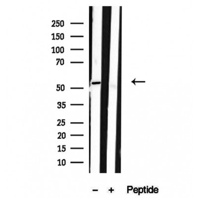 Western blot analysis of extracts from various samples, using SPTLC2 Antibody. 
Lane 1: 293 cells treated with the blocking peptide;
Lane 2: 293 cells;
Lane 3: Hela cells;
Lane 4: Mouse brain tissue;
Lane 5: Mouse liver tissue.