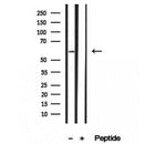 DF12232 staining HepG2 by IF/ICC. The sample were fixed with PFA and permeabilized in 0.1% Triton X-100,then blocked in 10% serum for 45 minutes at 25¡ãC. The primary antibody was diluted at 1/200 and incubated with the sample for 1 hour at 37¡ãC. An  Alexa Fluor 594 conjugated goat anti-rabbit IgG (H+L) Ab, diluted at 1/600, was used as the secondary antibod