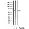 DF12232 staining HepG2 by IF/ICC. The sample were fixed with PFA and permeabilized in 0.1% Triton X-100,then blocked in 10% serum for 45 minutes at 25¡ãC. The primary antibody was diluted at 1/200 and incubated with the sample for 1 hour at 37¡ãC. An  Alexa Fluor 594 conjugated goat anti-rabbit IgG (H+L) Ab, diluted at 1/600, was used as the secondary antibod