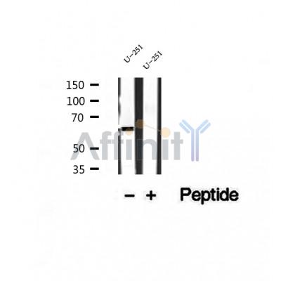 DF12234 at 1/100 staining Rat liver tissue by IHC-P. The sample was formaldehyde fixed and a heat mediated antigen retrieval step in citrate buffer was performed. The sample was then blocked and incubated with the antibody for 1.5 hours at 22¡ãC. An HRP conjugated goat anti-rabbit antibody was used as the secondary