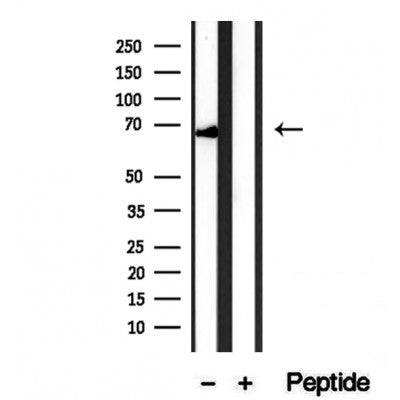 DF12235 staining HepG2 by IF/ICC. The sample were fixed with PFA and permeabilized in 0.1% Triton X-100,then blocked in 10% serum for 45 minutes at 25¡ãC. The primary antibody was diluted at 1/200 and incubated with the sample for 1 hour at 37¡ãC. An  Alexa Fluor 594 conjugated goat anti-rabbit IgG (H+L) Ab, diluted at 1/600, was used as the secondary antibod