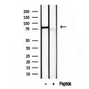 Western blot analysis of extracts from mouse brain, using TLE3 antibody. Lane 1 was treated with the blocking peptide.