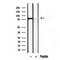 Western blot analysis of extracts from mouse brain, using TLE3 antibody. Lane 1 was treated with the blocking peptide.