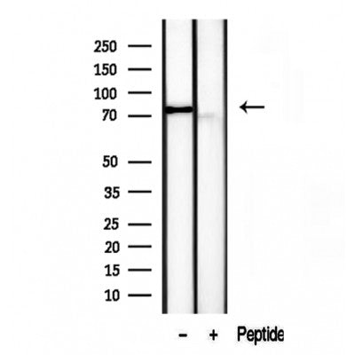 Western blot analysis of extracts from mouse brain, using TLE3 antibody. Lane 1 was treated with the blocking peptide.