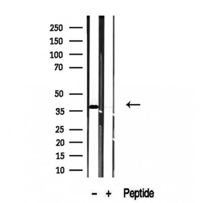 DF12238 staining HepG2 by IF/ICC. The sample were fixed with PFA and permeabilized in 0.1% Triton X-100,then blocked in 10% serum for 45 minutes at 25¡ãC. The primary antibody was diluted at 1/200 and incubated with the sample for 1 hour at 37¡ãC. An  Alexa Fluor 594 conjugated goat anti-rabbit IgG (H+L) Ab, diluted at 1/600, was used as the secondary antibod