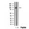 Western blot analysis of extracts from Mouse  muscle, using VPS16 Antibody. The lane on the left was treated with blocking peptide.