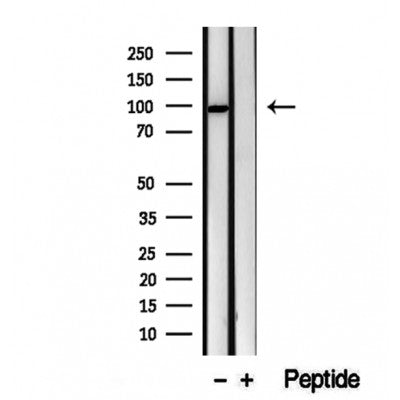 Western blot analysis of extracts from Mouse  muscle, using VPS16 Antibody. The lane on the left was treated with blocking peptide.