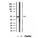 DF12243 staining HepG2 by IF/ICC. The sample were fixed with PFA and permeabilized in 0.1% Triton X-100,then blocked in 10% serum for 45 minutes at 25¡ãC. The primary antibody was diluted at 1/200 and incubated with the sample for 1 hour at 37¡ãC. An  Alexa Fluor 594 conjugated goat anti-rabbit IgG (H+L) Ab, diluted at 1/600, was used as the secondary antibod